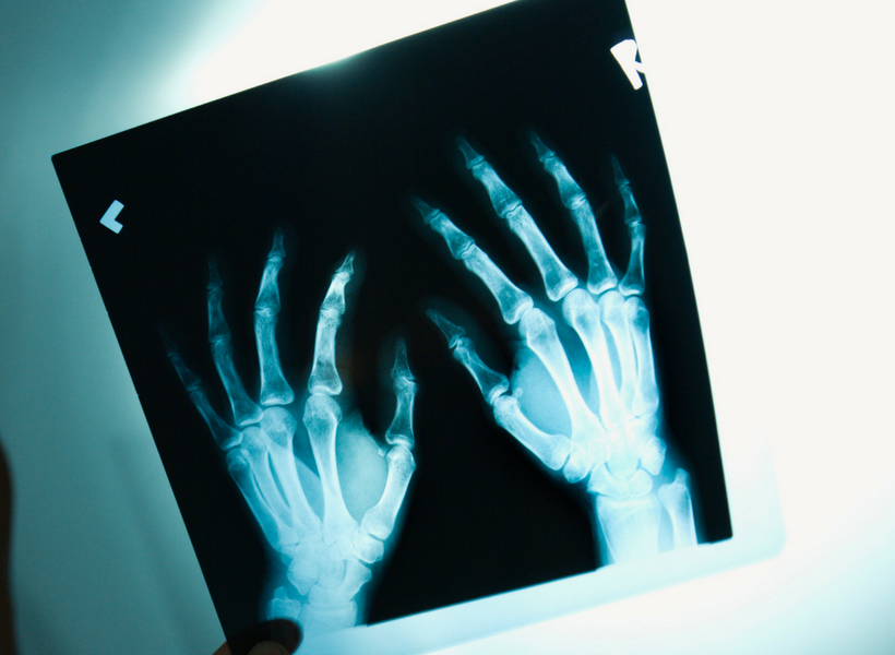 Tips for When Life Disables You As A Massage Therapist